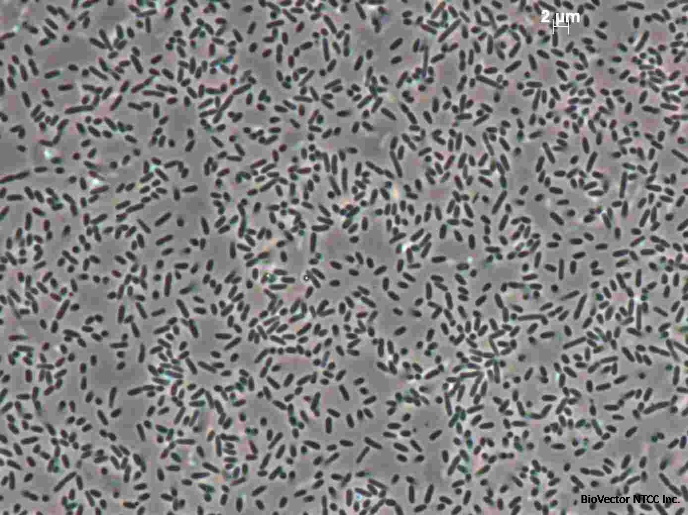 Pseudomonas aeruginosa PA500 | DSM 24600 | BacDiveID:12803