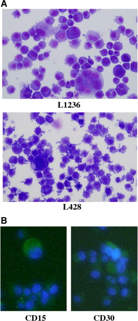 Tumorigenic Potential of Mononucleated Small Cells of Hodgkin Lymphoma Cell  Lines - ScienceDirect