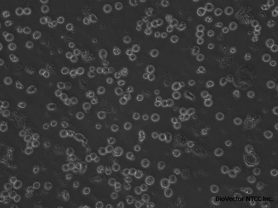 UT-7 TPO - Human Megakaryocytic cells - Viability 51 per cent.jpg