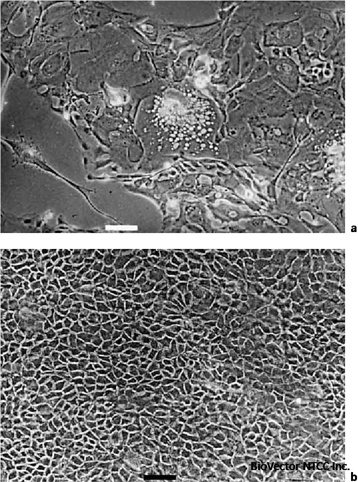 Figure 1 from The Human Sebocyte Culture Model Provides New Insights into  Development and Management of Seborrhoea and Acne | Semantic Scholar