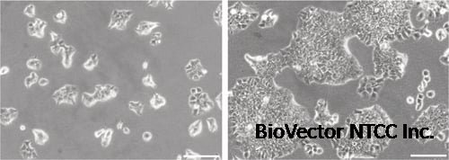 Alvetex Scaffold Protocol:Breast Invasive Ductal Carcinoma BT-474 Cell Line  (Inserts & Plates)