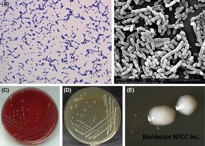 Lactobacillus paracasei - an overview | ScienceDirect Topics