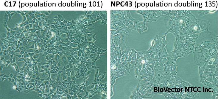 Establishment of Nasopharyngeal Carcinoma Cell Lines, Patient-Derived  Xenografts, and Immortalized Nasopharyngeal Epithelial Cell Lines for  Nasopharyngeal Carcinoma and Epstein–Barr Virus Infection Studies -  ScienceDirect