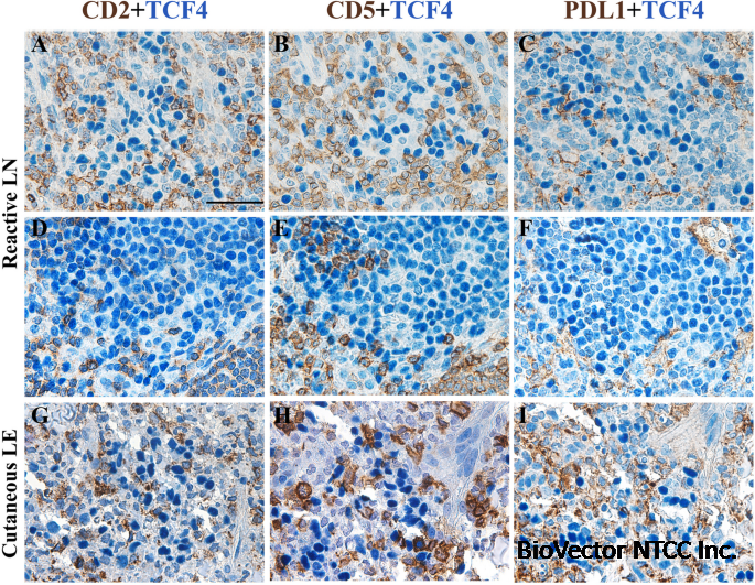 Plasmacytoid dendritic cells at the forefront of anti-cancer immunity:rewiring strategies for tumor microenvironment remodeling | Journal of Experimental & Clinical Cancer Research | Full Text