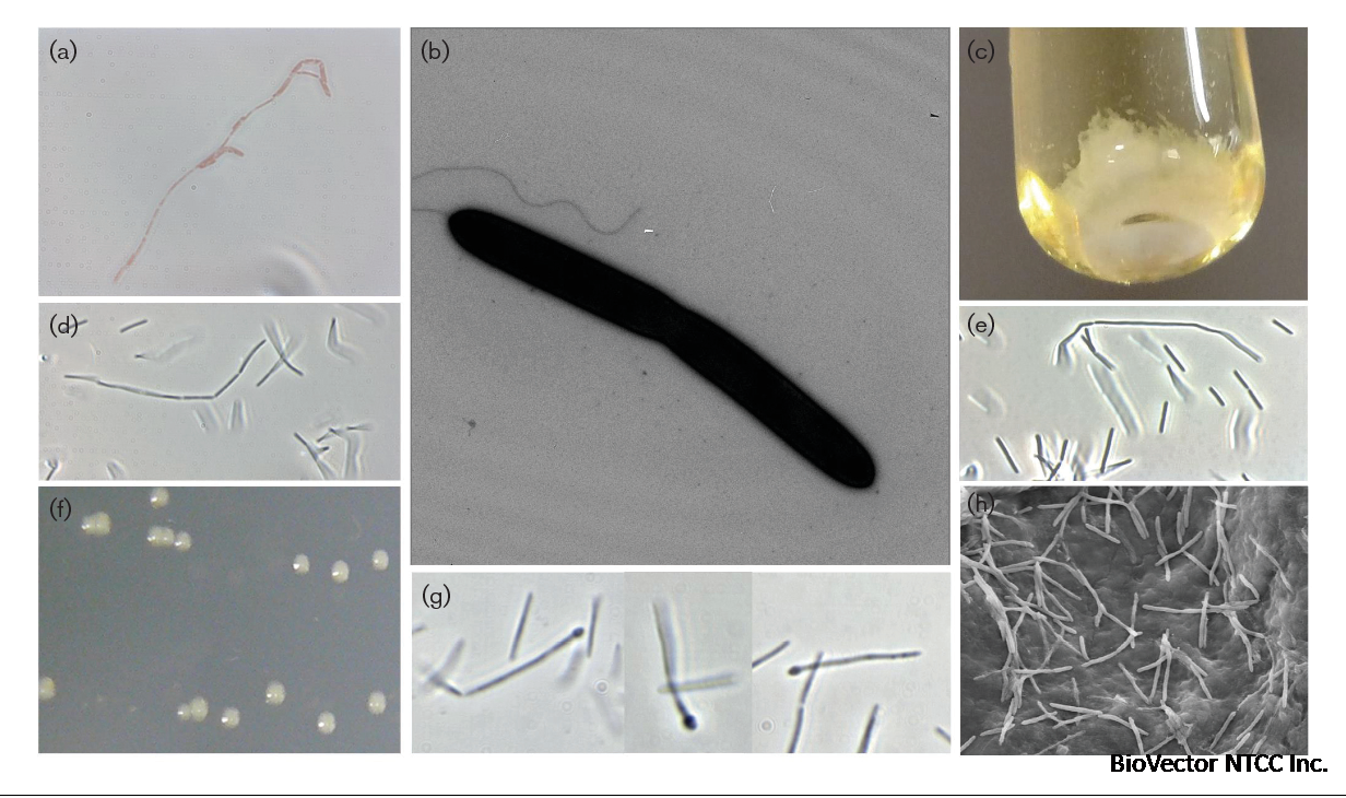 Kineothrix alysoides, gen. nov., sp. nov., a saccharolytic  butyrate-producer within the family Lachnospiraceae. | Semantic Scholar