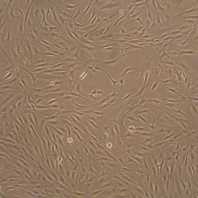 HFLS | Primary Human Fibroblast Like Synoviocytes | Cell Applications