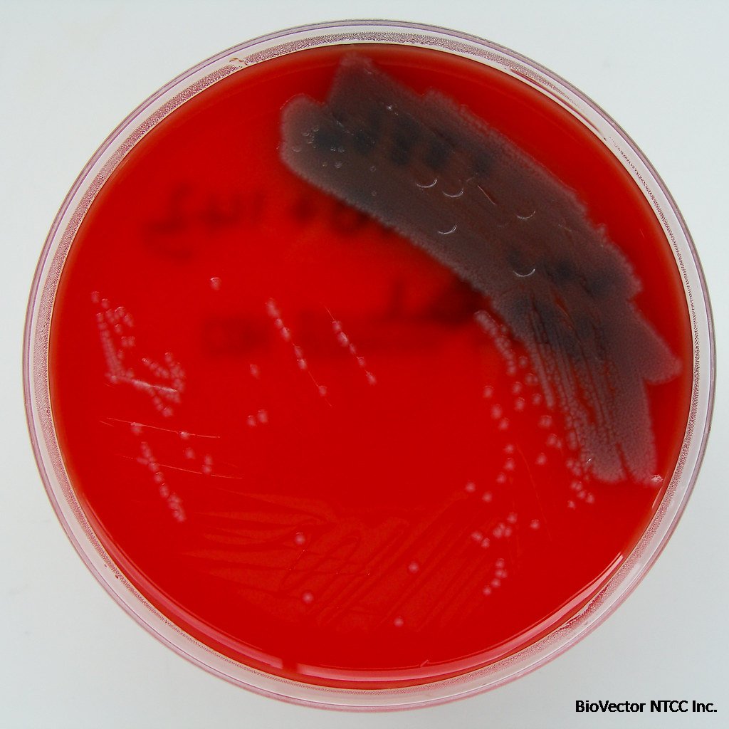 Pseudomonas aeruginosa on Columbia Blood Agar | Pseudomonas … | Flickr