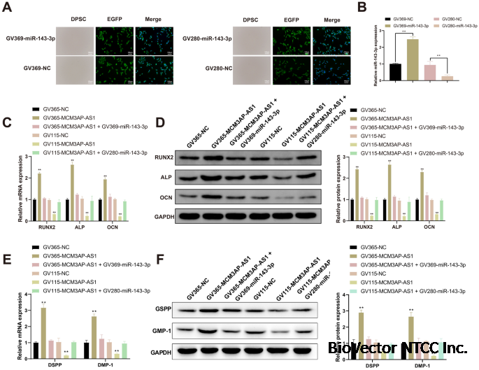 Overexpression of long noncoding RNA MCM3AP-AS1 promotes osteogenic  differentiation of dental pulp stem cells via miR-143-3p/IGFBP5 axis |  Human Cell