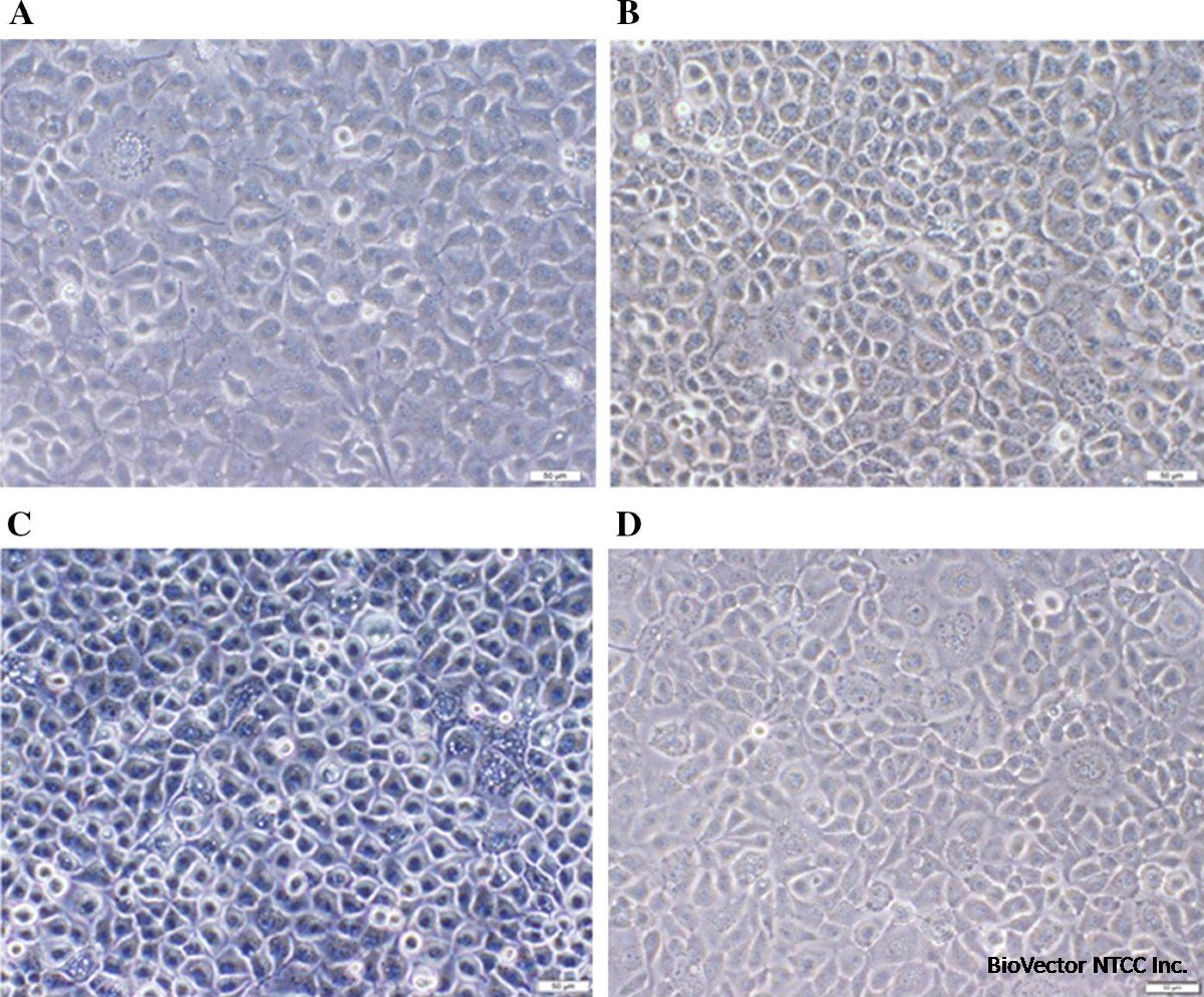 Development and biochemical and immunological characterization of early passage and immortalized bovine intestinal epithelial cell lines from the ileum of a young calf | Cytotechnology