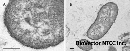 Ultrastructural Analysis of the Extracellular Matter Secreted by the Psychrotolerant Bacterium Pseudoalteromonas antarctica NF3 | Microbial Ecology