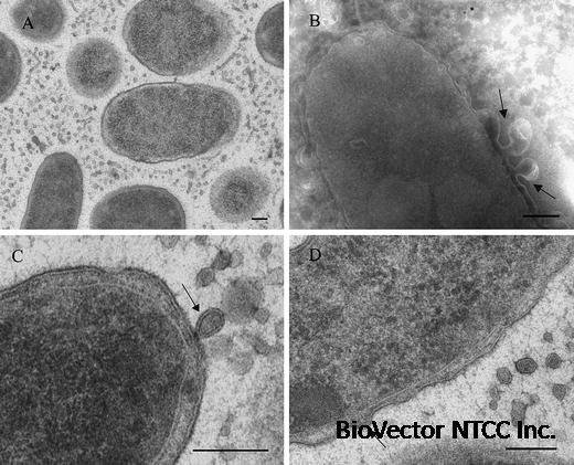 Ultrastructural Analysis of the Extracellular Matter Secreted by the Psychrotolerant Bacterium Pseudoalteromonas antarctica NF3 | Microbial Ecology