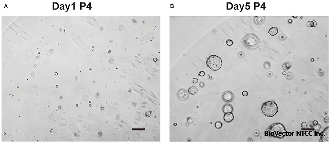 Frontiers | Highly Efficient Methods to Culture Mouse Cholangiocytes and Small Intestine Organoids