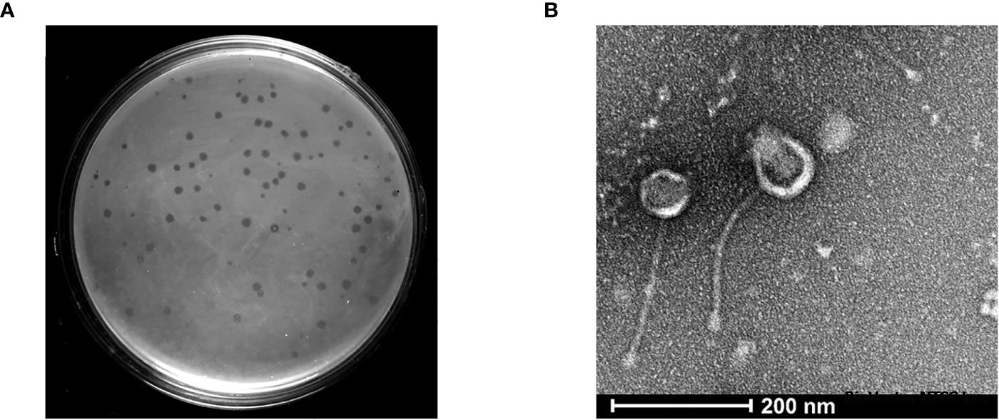Frontiers | Isolation and characterization of a novel mycobacteriophage  Kashi-VT1 infecting Mycobacterium species