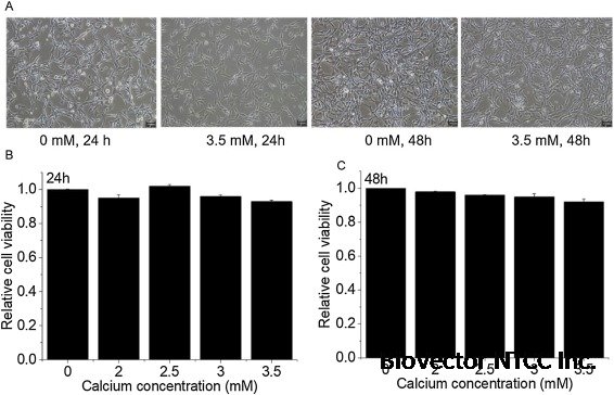 Calcium promotes differentiation in ameloblast-like LS8 cells by downregulation of phosphatidylinositol 3 kinase /protein kinase B pathway - ScienceDirect