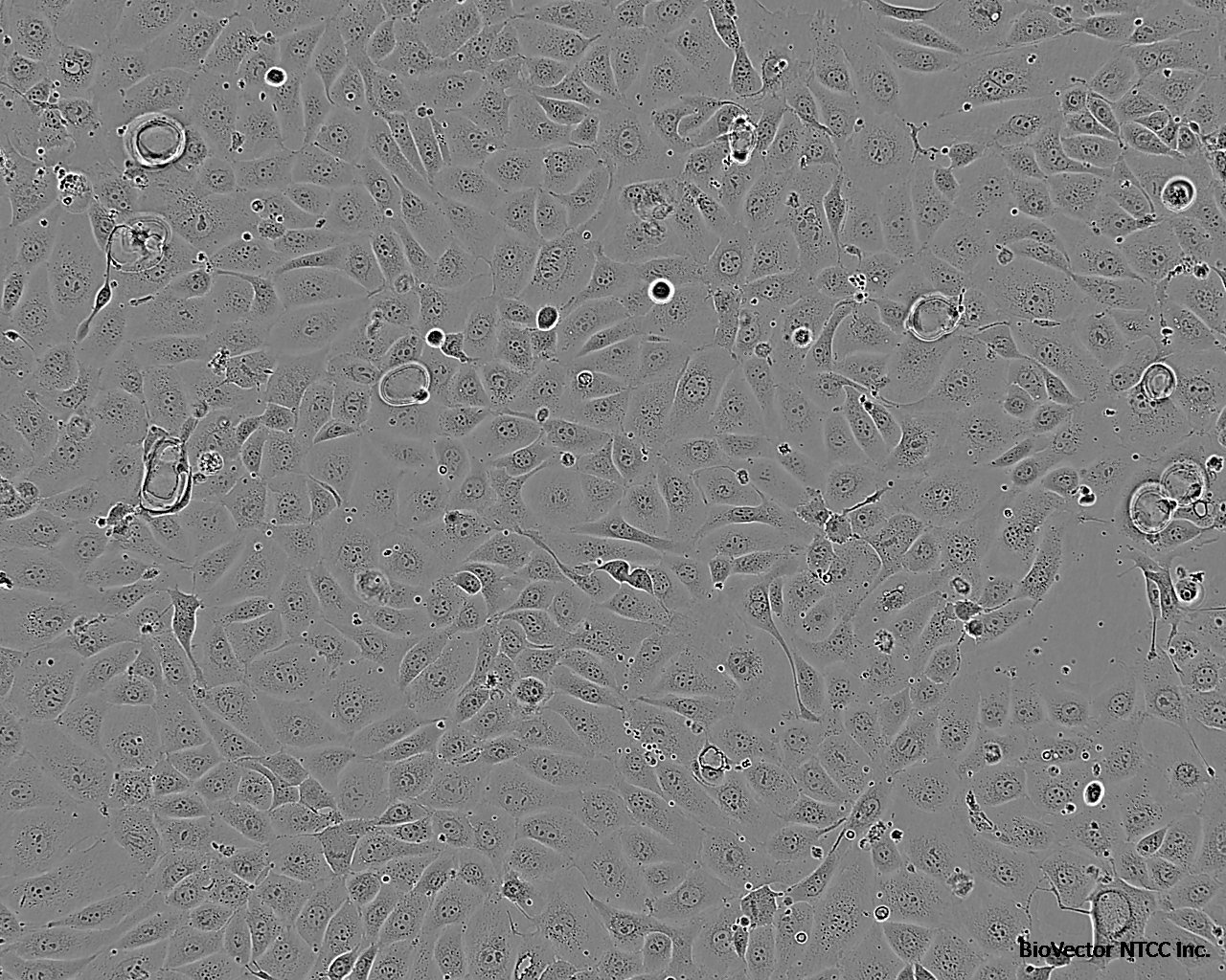 hEM15A Cell:人永生化子宫内膜异位症患者在位内膜间质细胞系价格 1123元/cells 厂家:上海宾穗生物科技有限公司