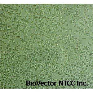 OCI-LY8 Cell Line|人弥漫大B淋巴瘤细胞价格厂家：上海弘顺生物科技有限公司