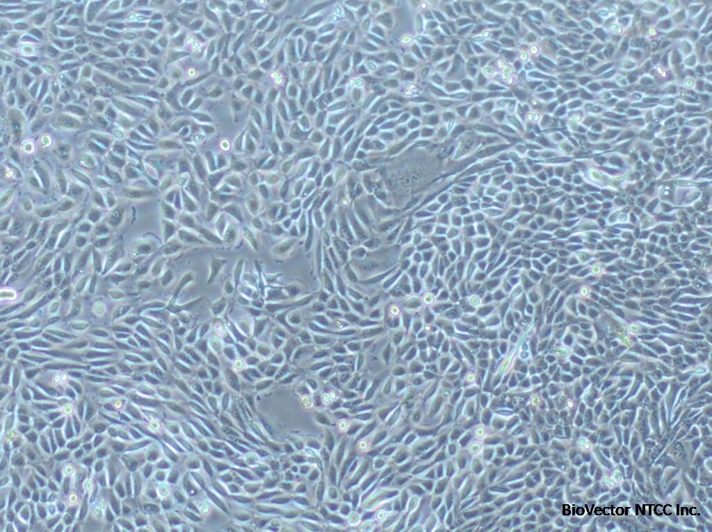 CLTH / PC, Primary Human Prostate Cancer Cell Line – celther.com