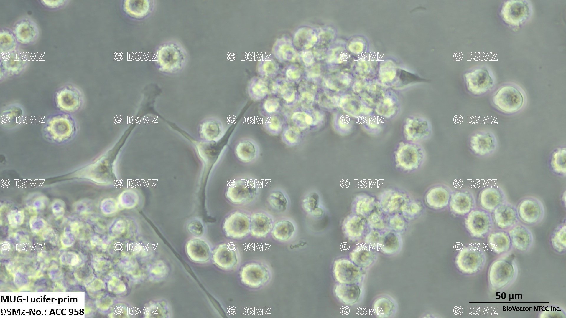 German Collection of Microorganisms and Cell Cultures GmbH:Welcome to the  Leibniz Institute DSMZ | MUG-Lucifer-prim