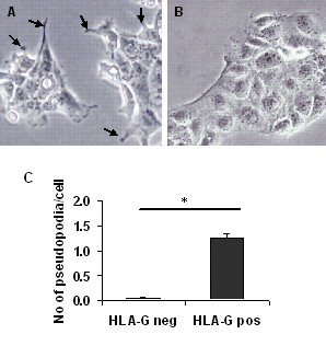 The first trimester human trophoblast cell line ACH-3P:A novel tool to  study autocrine/paracrine regulatory loops of human trophoblast  subpopulations – TNF-α stimulates MMP15 expression | BMC Developmental  Biology | Springer Nature