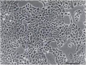 Featured Reagent of the Week Cell Line PEO1 and PEO4 - Ximbio