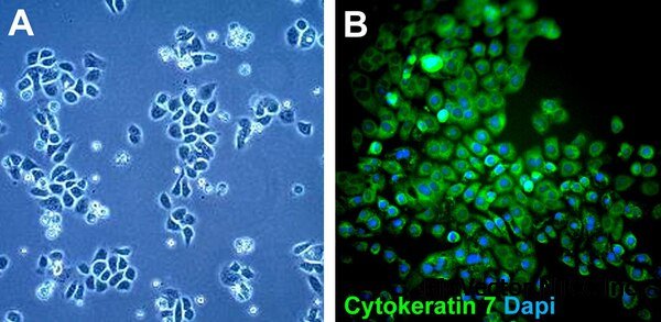 AY-27 Rat Bladder Tumor Cell Line | SCC254