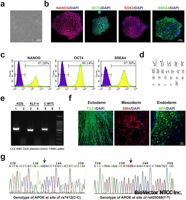 Generation of induced pluripotent stem cell line (IPTi002-A) from an  87-year old sporadic Alzheimer's disease patient with APOE3 (ε3/ε3)  genotype - ScienceDirect