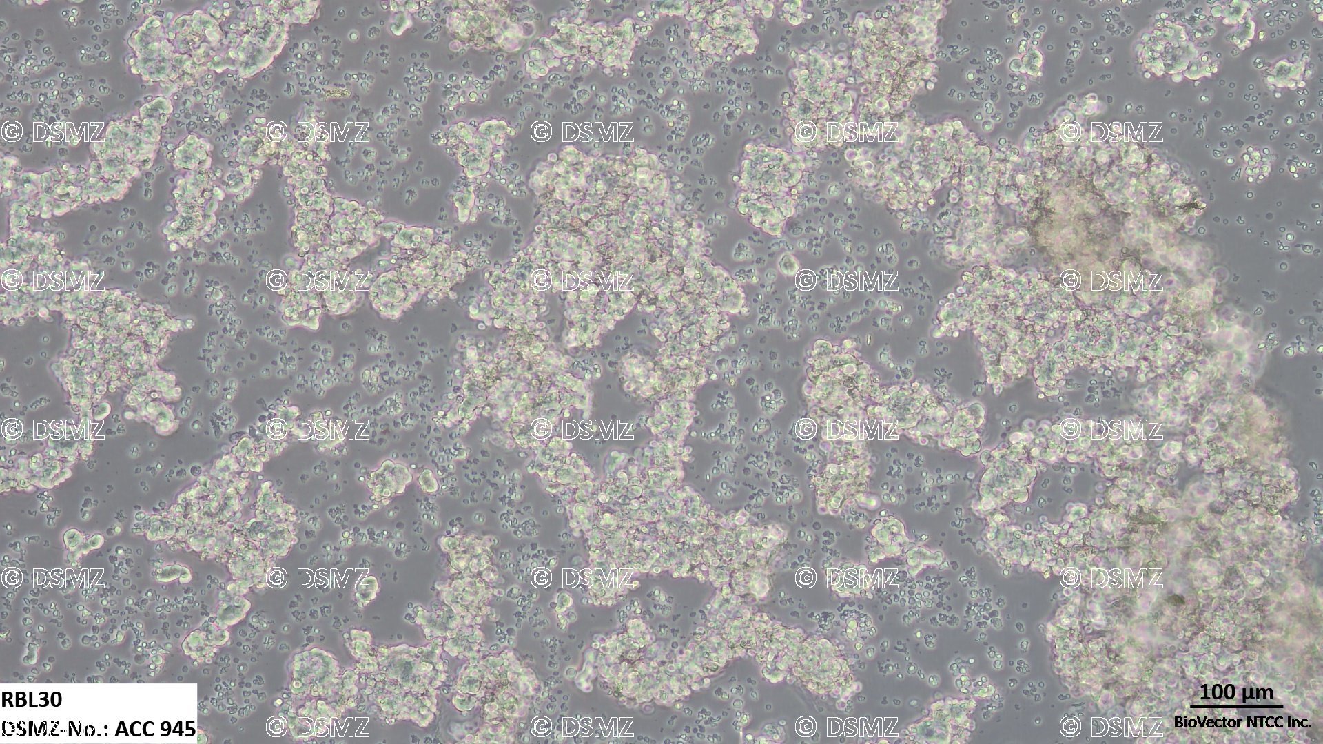 German Collection of Microorganisms and Cell Cultures GmbH:Welcome to the  Leibniz Institute DSMZ | RBL30