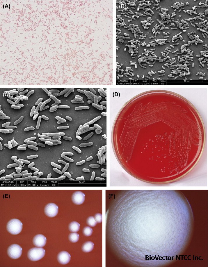 Aggregatibacter Actinomycetemcomitans - an overview | ScienceDirect Topics