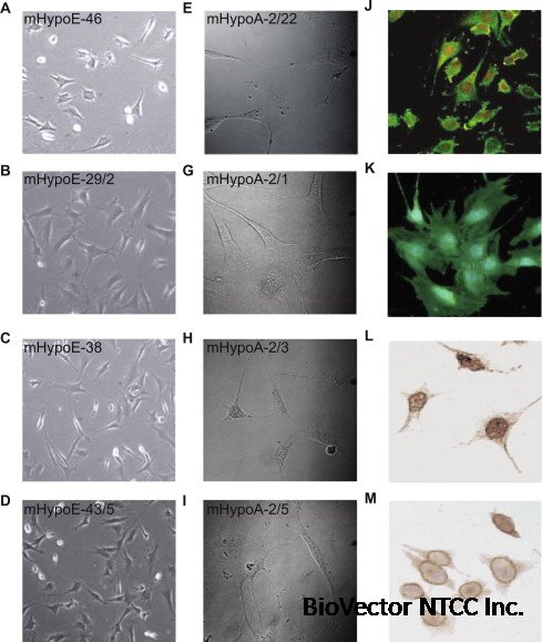 Hypothalamic cell lines to investigate neuroendocrine control mechanisms -  ScienceDirect